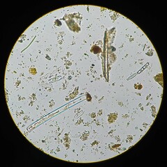 Encyonopsis hustedtii