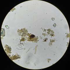 Encyonopsis hustedtii