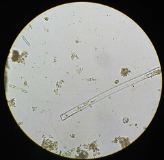 Achlya racemosa