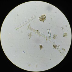 Achlya racemosa