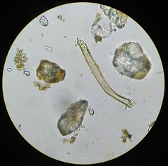 Planktothrix rubescens