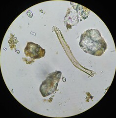 Achlya racemosa