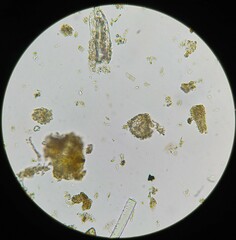 Achlya racemosa