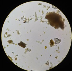 Pseudanabaena galeata