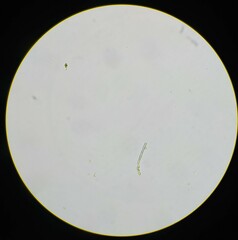 Planktothrix rubescens
