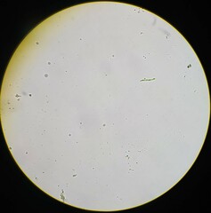 Planktothrix rubescens