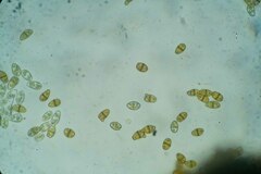 Scapania cuspiduligera