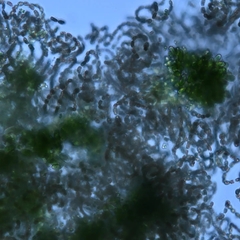 Dolichospermum lemmermannii