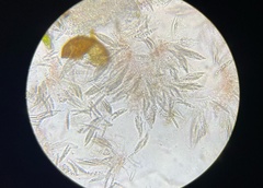 Xanthonectria pseudopeziza