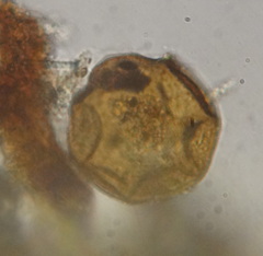Arcella conica