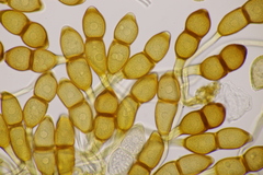 Puccinia phragmitis