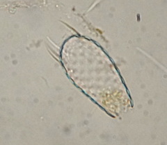 Euglypha acanthophora