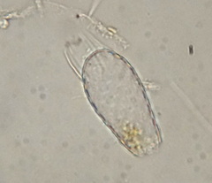 Euglypha acanthophora