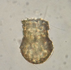 Codonella