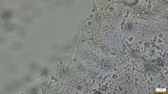 Nectria pseudotrichia