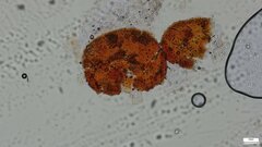 Nectria pseudotrichia