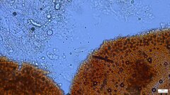 Nectria pseudotrichia