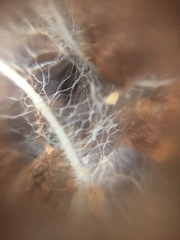 Fungi