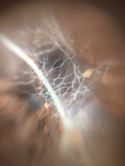 Fungi
