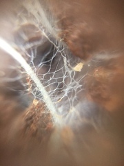 Fungi