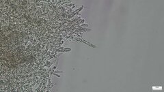 Rhizochaete radicata