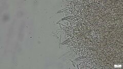 Rhizochaete radicata