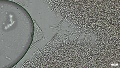 Rhizochaete radicata
