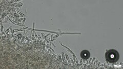 Rhizochaete radicata