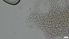 Rhizochaete radicata