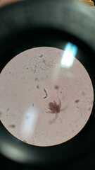Multicrustacea