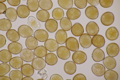 Uromyces viciae-fabae