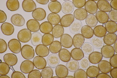 Uromyces viciae-fabae