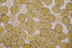 Uromyces viciae-fabae