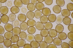 Uromyces viciae-fabae