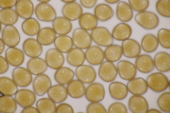 Uromyces viciae-fabae