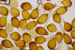 Uromyces viciae-fabae