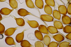 Uromyces viciae-fabae