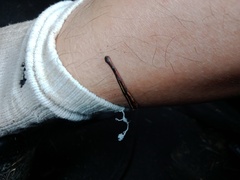 Chtonobdella limbata