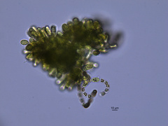 Dolichospermum lemmermannii