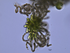 Dolichospermum lemmermannii