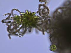 Dolichospermum lemmermannii