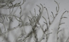 Cladophora liniformis