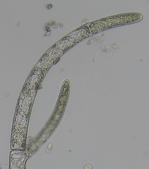 Cladophora liniformis