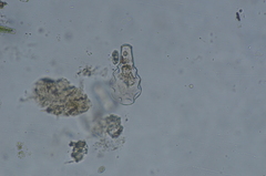 Hyalosphenia