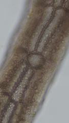 Vertebrata nigra