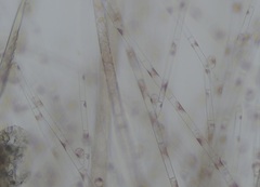 Colaconema dasyae