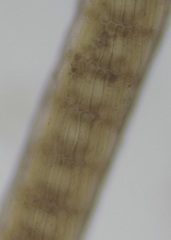 Vertebrata lanosa