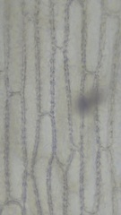 Chondria dasyphylla