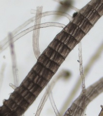 Vertebrata fucoides