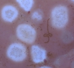 Mesophyllum lichenoides